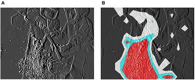 Visualization of Airborne Particles as a Risk for Microbial Contamination in Orthopedic Surgery